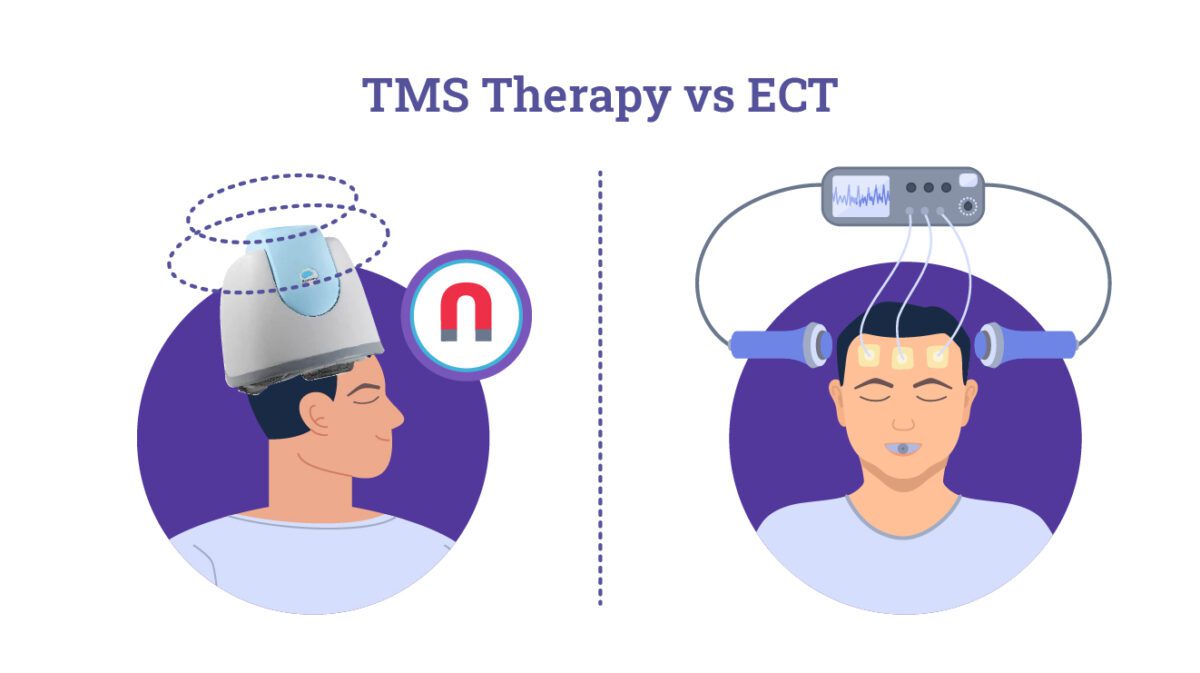 Tms Therapy Vs Ect Whats The Difference Madison Avenue Tms