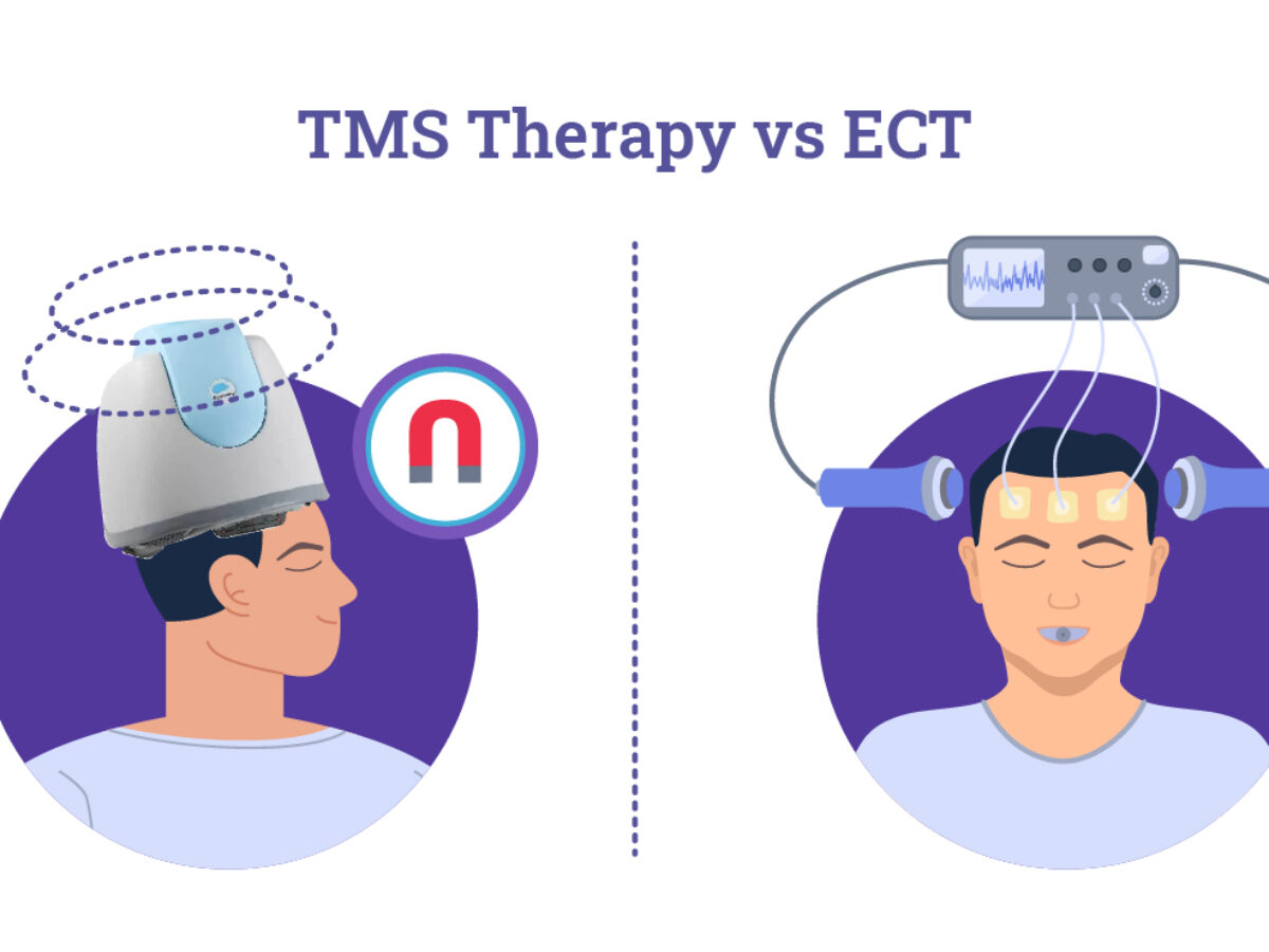 TMS vs ECT  Compare The Best Depression Treatments (2021)